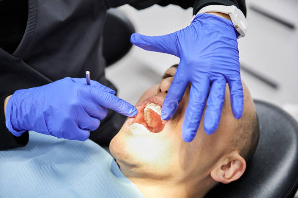 Best Emergency Dental Extractions in Ilco, WA